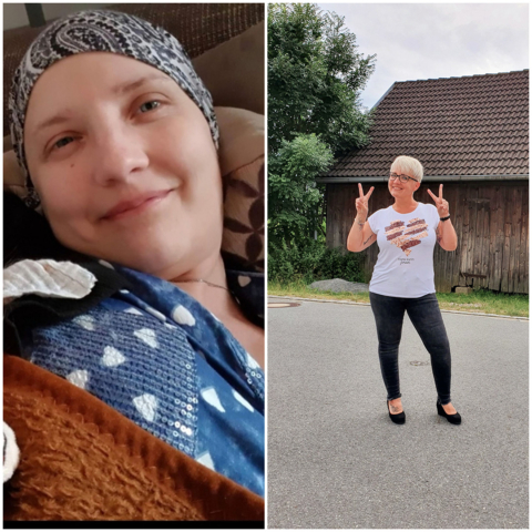 Frau während und nach der Krebserkrankung